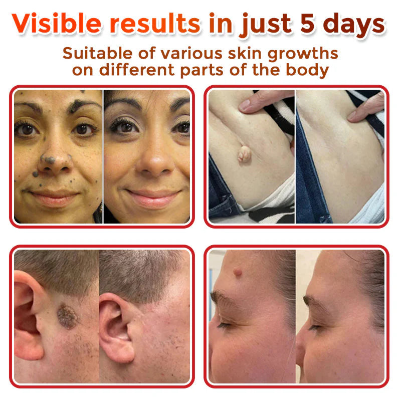 Divifit Removal Patch