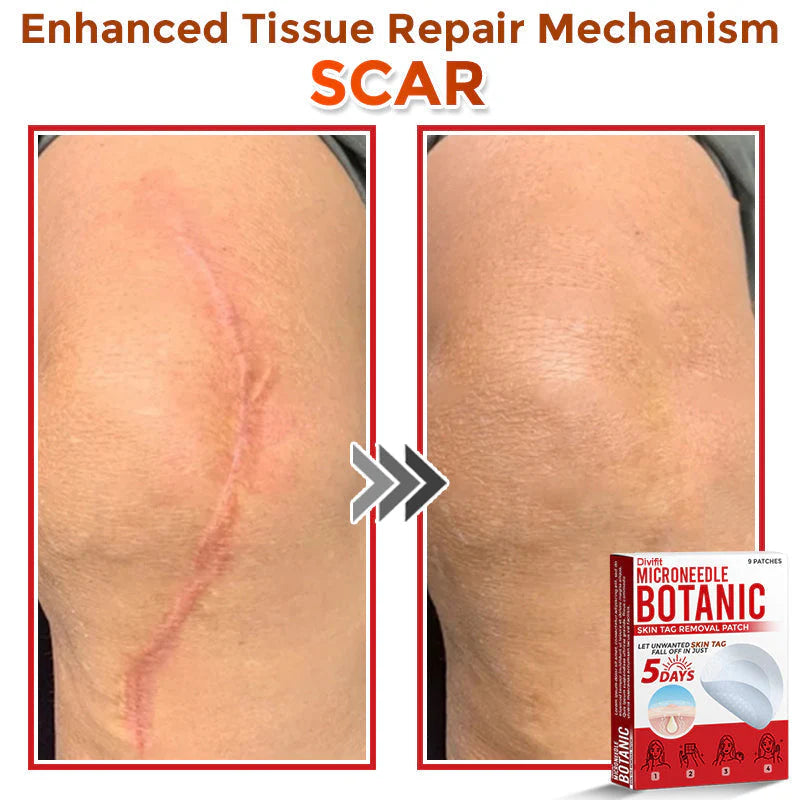 Divifit Removal Patch