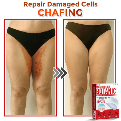 Divifit Removal Patch