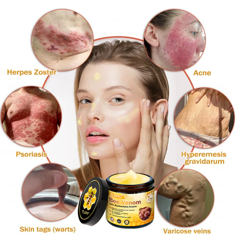 🍅🔥TLOPA® Bee Venom Skin Restoration Cream — 🔥Limited Time 80% OFF🔥