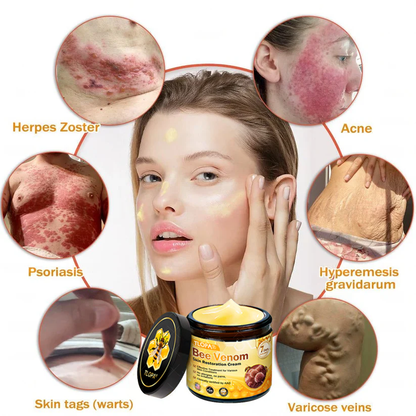 🍅🔥TLOPA® Bee Venom Skin Restoration Cream — 🔥Limited Time 80% OFF🔥