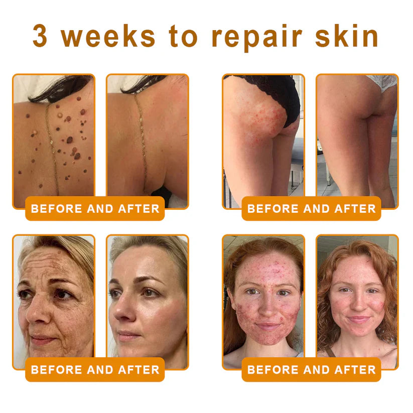 🍅Made and Shipped from Canada 💯TLOPA® Bee Venom Skin Restoration Cream⏳ LAST DAY 80% OFF⚡