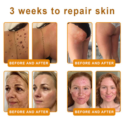 🍅Made and Shipped from Canada 💯TLOPA® Bee Venom Skin Restoration Cream⏳ LAST DAY 80% OFF⚡