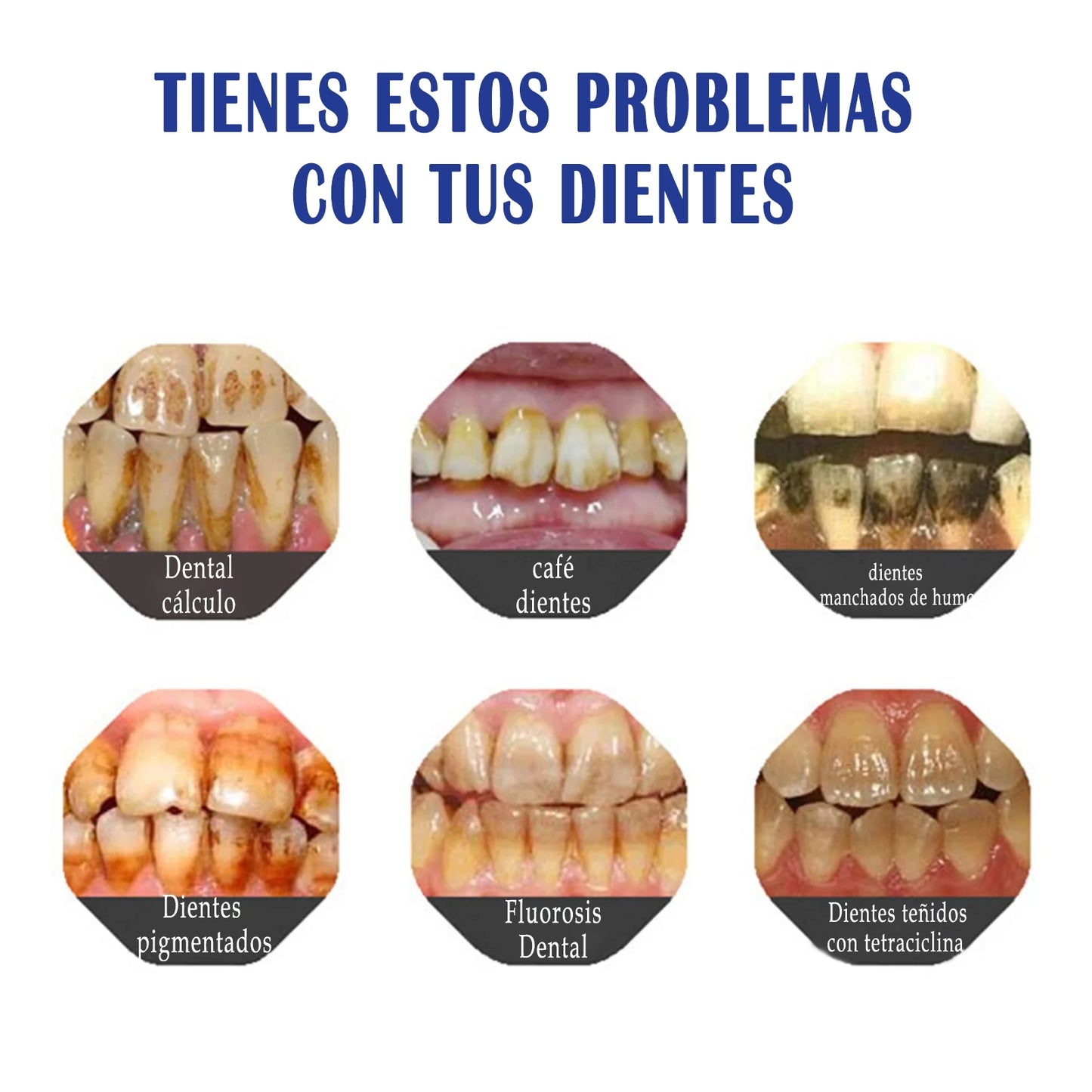 🔥Último día 50% de descuento 🔥- Tienda oficial💎 Pasta dental con hidroxiapatita sin flúor