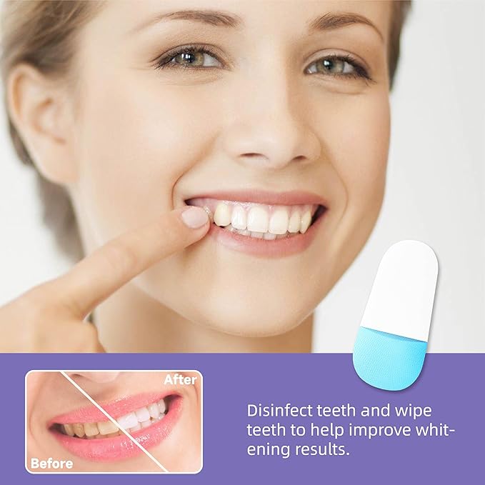 TLOPA® Official Store💎Whitening Strips