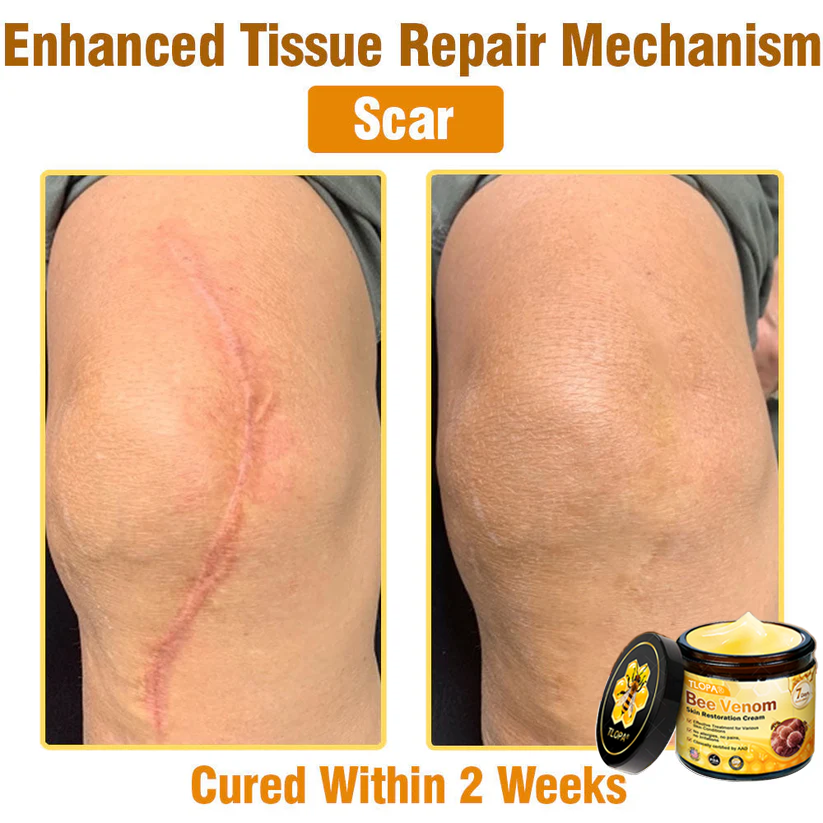 🍅🔥TLOPA® Bee Venom Skin Restoration Cream — 🔥Limited Time 80% OFF🔥