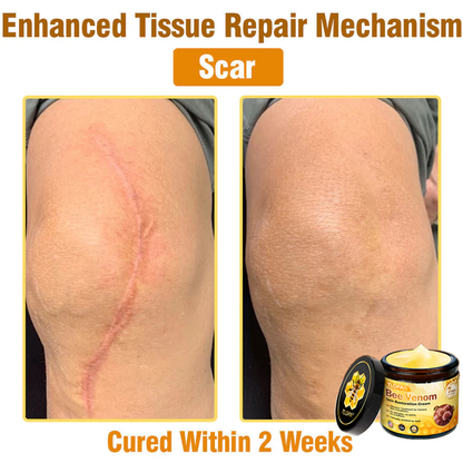 🍅🔥TLOPA® Bee Venom Skin Restoration Cream — 🔥Limited Time 80% OFF🔥