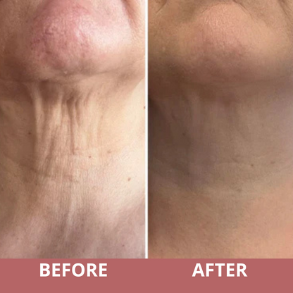 TLOPA® Official Store💎Neck Sculpt Firming Cream – Tighten, Lift & Restore Youthful Skin