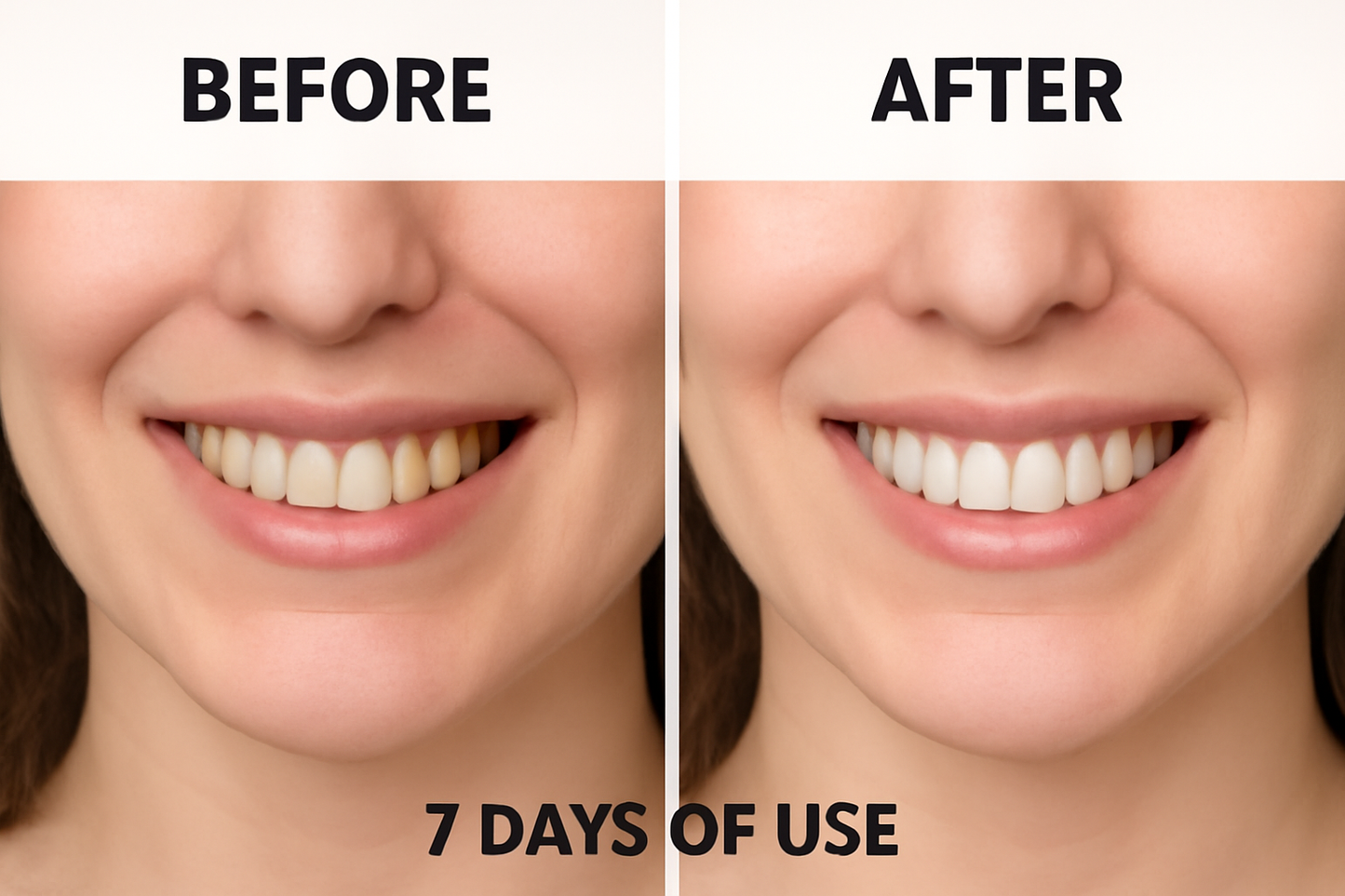TLOPA® Teeth Whitening Strips
