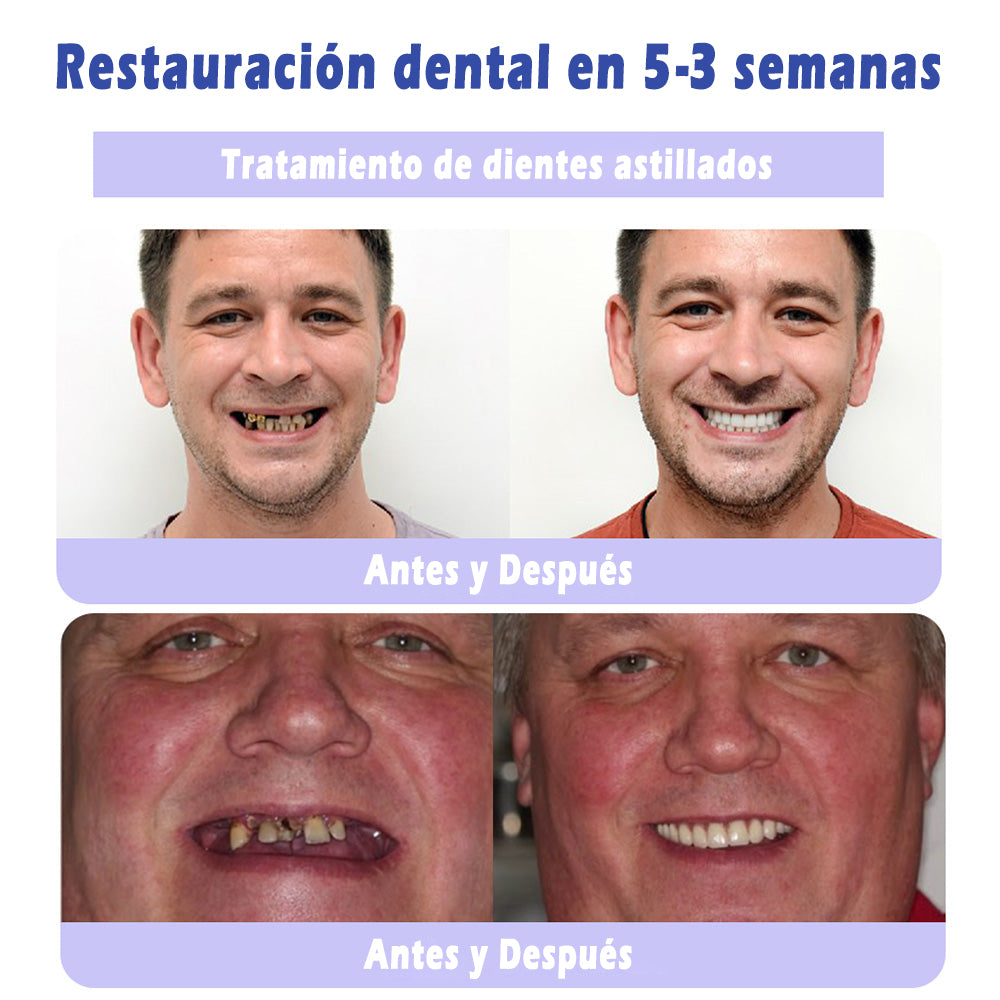 🔥Último día 50% de descuento 🔥- Tienda oficial💎 Pasta dental con hidroxiapatita sin flúor