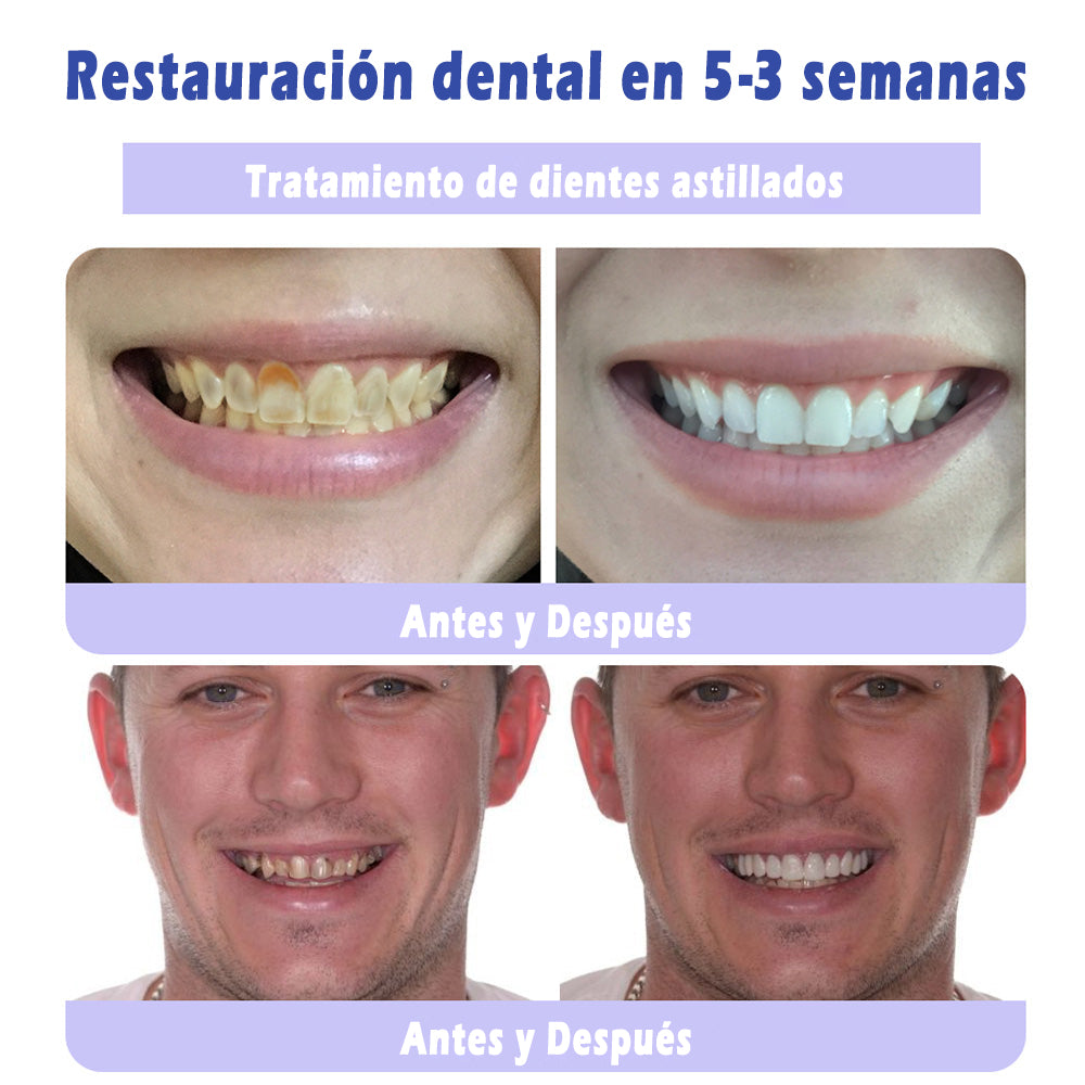 🔥Último día 50% de descuento 🔥- Tienda oficial💎 Pasta dental con hidroxiapatita sin flúor