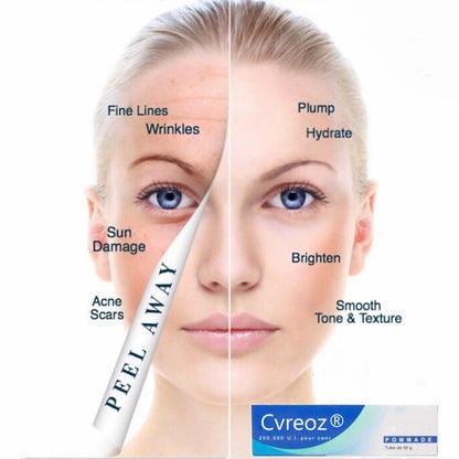 Cvreoz®Official Store💎Retinol Cream + Hyaluronic Acid Cream Bundle